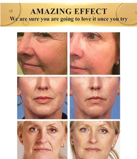 Bee Venom Repair Cream – Deep Moisturizing Formula to Soothe Redness, Repair Damaged Skin & Strengthen Your Skin Barrier - 60G 🔥 BUY 1 GET 1 FREE 🔥