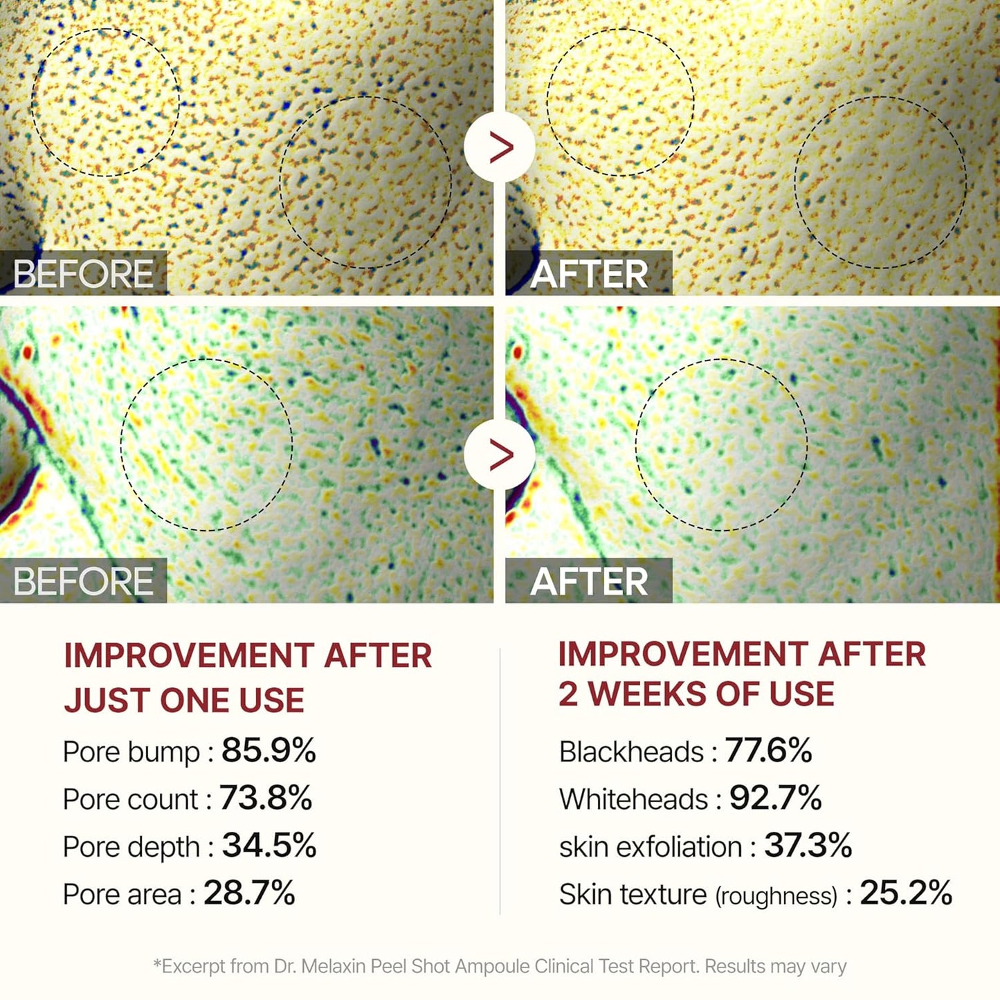 Dr. Melaxin Peel Shot Glow Rice Ampoule Duo – Brightening, Exfoliating & Moisturizing Serum for All Skin Types - 2 Pack