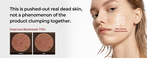 Dr. Melaxin Peel Shot Glow Rice Ampoule Duo – Brightening, Exfoliating & Moisturizing Serum for All Skin Types - 2 Pack